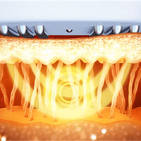 ���������Ժ��Խ��Խ����Ϊʲô��������Ƥ�����ɳ���