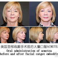 ��һ�£��ߵ���ʲô���ߵ�������빦Ч~