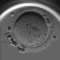 Ψһ������ȷ�İ�֢��������������Ů�ԡ���