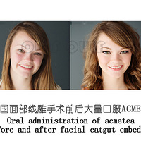 ����һ�£��ߵ���ʲô���ߵ�������빦Ч~