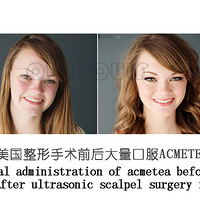 ΢���������Ļָ��ڡ�΢������ͷ��һ�������Сʱ~