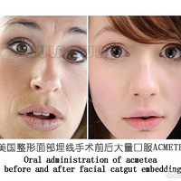 ʵ���ˣ��������ߵ��������ߵ��ܱ��ֶ೤ʱ��~