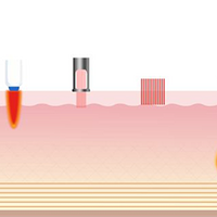 ҽ��֪ʶ���뵺������Ч����ô�����뵺�����ڿ���ά�ֶ��