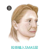 ����΢������Ч���ò��á�v������������ά�ֶ��