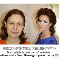 Ϊʲô���꼪�����²���Ч�����������꼪��ÿ��Կ���Ч��~