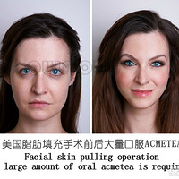 ֱ�潲�⣺����֬������Σ���ͺ���֢���������֬���к���֢��