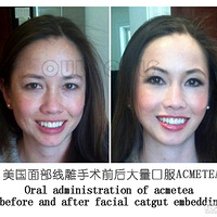 �Ȱȣ����������沿����ά�ֶ�á������������Ч�����ּ���~