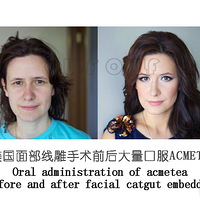 ��һ���ߵ��ܱ��ֶ�á���һ���ߵ���ά�ּ��ꡢ���˵~