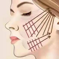 ΢�����ʺ϶����������΢��������Ч������Ǽ�����~