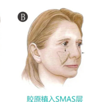 ���գ�΢������ʲôԭ����΢����������ά�ֶ��