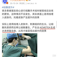 ����һ�£����������沿����ά�ֶ�á������������Ч�����ּ���