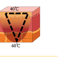 ��������ʲô �������沿���������Ч������תʱ�ⶨ���ഺ~