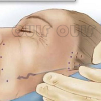 ���������ߵ��ÿ�����ȫ�ָ����ߵ��ע������ǧ��𲻵�����