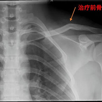 ���������ط������ˣ����ë���ö��˶��С�