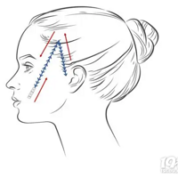 ���Ľ� Ĥ �� ������������Ǯ���� Ĥ �� ��������ά�ֶ��~