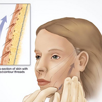 ʲô��΢��������������΢����3.0�۸����Ǿ���~