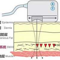 �� �� ����ԭ�������ã��� �� �������һ��Ч�����~