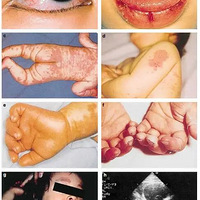 Ů����ָͷ����ֺͷ��ʼ��Ƥ��ҽ��˵����һ���Ҵ���û�����ļ���