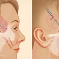 ΢��������ô���ġ�΢�����ʺ϶��������