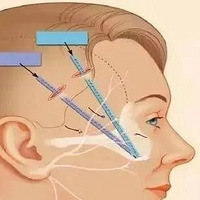 ��Ĥ���������������Σ���Ĥ�������ʺ϶�������~