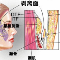 smas��Ĥ�����������������ά�ֶ��