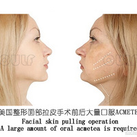 �����沿��Ƥ�����к���֢��������Ƥ�ĺ���֢�ҿ���~