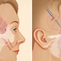 ֪ʶƪ��΢����Ч����ô����΢���������ܱ��ּ���