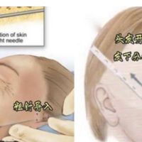 ΢������ÿ��Իָ���΢���������ȫ����~