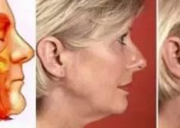 ���ؽ�Ĥ�������ʺ϶������ġ���Ĥ�����ָ����Ƕ��~