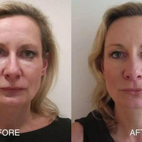 �� ������ô������ ����һ��Ҫ�����β���Ч��һ��˵��~