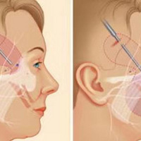 ��Ĥ������ο��ٻָ�����Ĥ��Ƥ������ά�ּ���~