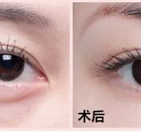 �۴��г������ܱ����ꡢȥ�۴�������ά�ּ��ꡢ������~