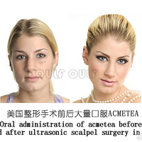 ��������ʲô������Ŀ���ƽ�����Ч������~