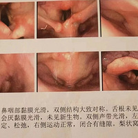 ���������������챻�򱬵ĳ�̥���������ˣ��˿���ֱ�Ӿ�û�ˡ�