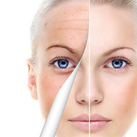 ΢��������ô���ģ�΢�����沿��������֢����ʲô��