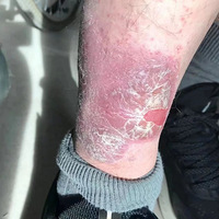 ���ÿ����Ķ����ͷƤм����ѩ��һ��������