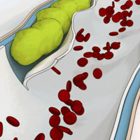 ��Ѫ֬���ꡱ�����Ѫʲô����ҽ��������һ��Ա�ͼ