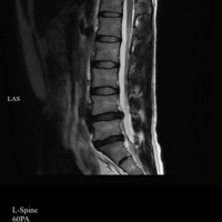 00��С�����齩Ӳ�޷����ߣ�ҽ�����ѣ���Щ֢״�𵱡�̫���ˡ�