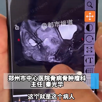 13��Ů��Ƶ��ƨ���ۣ���ȷ������ϰ˾ŵ������֢״Ҫ����