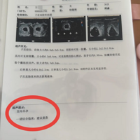 ��ÿ�β��춼���ֶ��һ̥�����и��������ڴ�һ̥���İ�̥