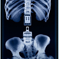 ����Ĺ����洴��~~����durex�ľ�����