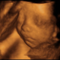 29��ɹɹ����а�