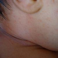 ����������ʲô  ʪ����