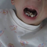 �죡11��Ů���ϵ���80�갢�ţ�ҽ������Ľ������̾Ϣ��