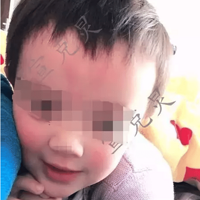 ��ʹ��4���к�С������ˣ��ת�۵�����Ѫ���