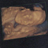 �����õ���û�����ӵ���Խ��Խ��Խ��ԽԲ