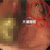 ����һ56���ȥ������ҽ�����ȿ��֣���һ�����ڣ�