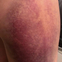 ���ǳ��ϼұ�ȴ�����ޣ������Ŵ�Ů�����ӷ��� ����Ҳ������