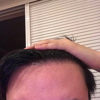 5���µ�ֲ��Ч������