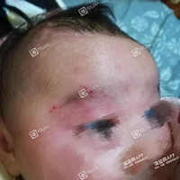 δ���¶��ӱ�����4��ֶŮ���� �۾���ͱ��һ��Ѫ�㣡���Ż�˵��